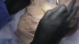 Advanced Anatomy using a Cadaver Trailer