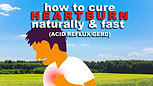 How To Cure Heartburn Naturally & Fast (Acid Reflux   GERD)