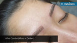 Microblading Combo Before & After