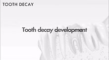 Tooth decay
