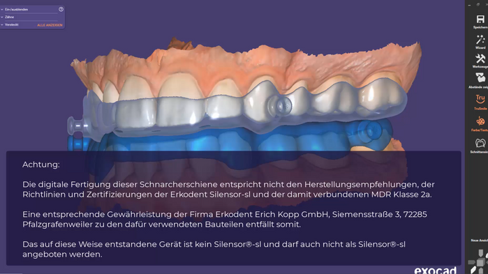 Die Konstruktion einer Schnarcherschiene im exocad DentalCAD (UT)