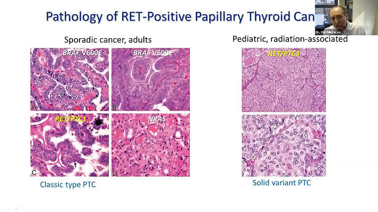 RET Fusions in Thyroid Cancer: Prevalence, Histologic Features, & Detection