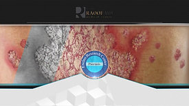 Dermatology_Research_Spanish