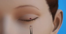 Oculoplastics Animation: Eyelid Lesion Surgery
