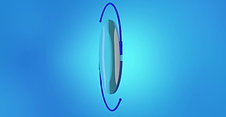Cataracts Animation: Toric Lens