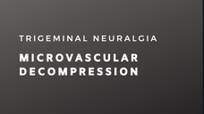 Trigeminal Neuralgia