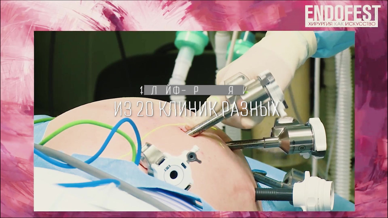 Пост-релиз VIII-й Московский Международный Фестиваль Эндоскопии и Хирургии