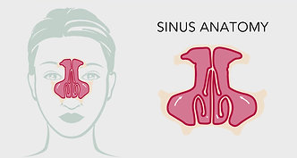 Sinus-Surgery