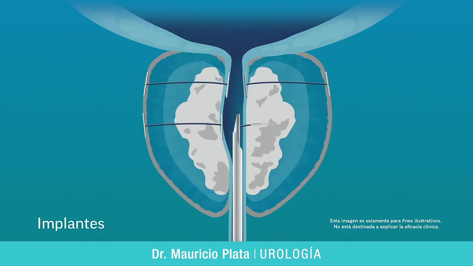 Mauricio Plata - Urología
