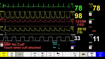 Simulated Patient Monitor-1
