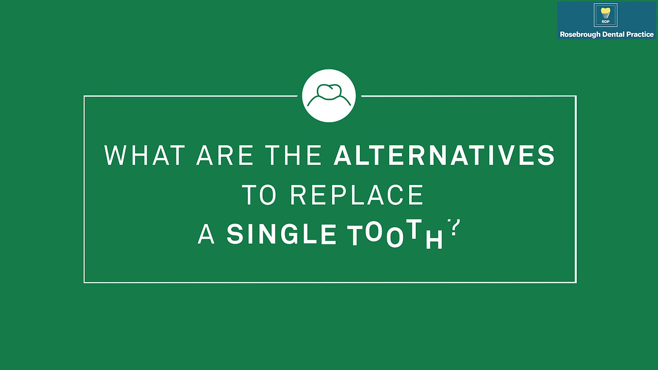 Alternatives to replace single tooth