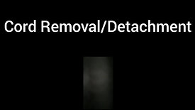 Cord Removal/Detachment