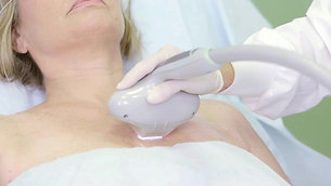 LimeLight® IPL Therapy 