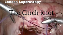 The Cinch knot