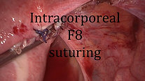 Intracorporeal F8 suture
