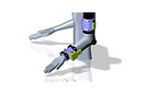 The ROM2 Splint - Shoulder Internal/External Rotation