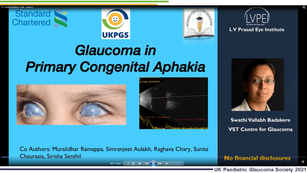 12 - Swathi Badakere -Glaucoma in primary congenital aphakia 
