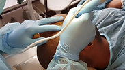 Scalp Micropigmentation Procedure