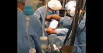 Heart Assist Device Surgery