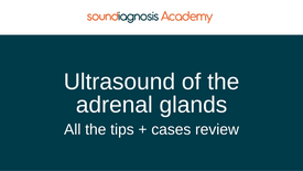 Ultrasound of the Adrenal glands: all the tips and cases review.