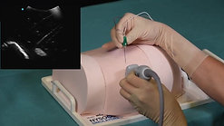 MiniSim Sciatic Transglutal Ultrasound Block
