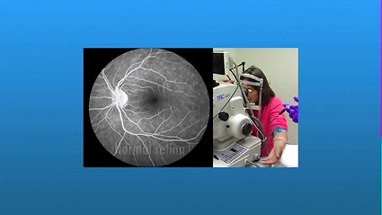 Fluorescein Angiography for Diabetic Retinopathy