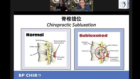 Subluxation Cycle脊椎错位循环