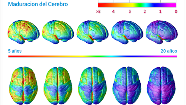 Mapeo Cerebral en Neura Institute