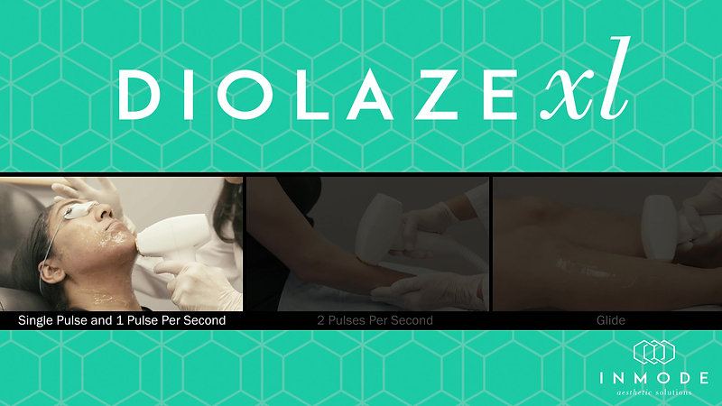 DiolazeXL-Intro