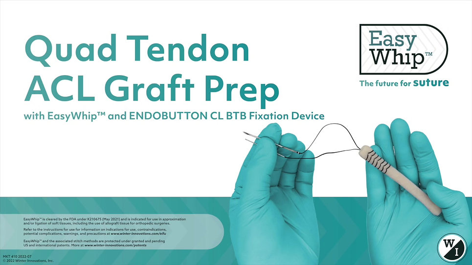Quad Tendon ACL Graft Prep - Endobutton