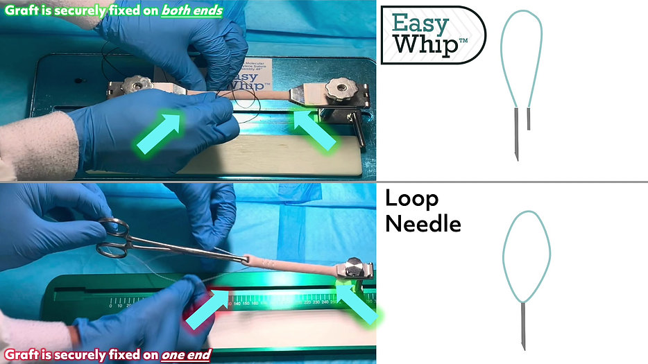 EasyWhip™ vs Loop Needle
