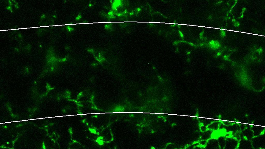 Microglia Respond by Extending Their Processes Towards Neurons in Hippocampal Brain Slice with Glutamate Treatment