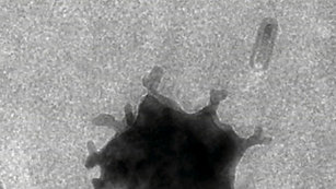 Croissance d'une nanoparticule dendritique en phase liquide.  Advanced Structural and Chemical Imaging, 2 (1), 9-19
