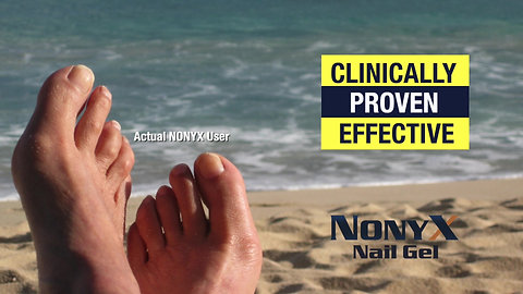 NONYX is Clinically Proven Effective