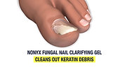 NONYX Fungal Nail Clarifying Gel, for Clear, Healthy-Looking Nails