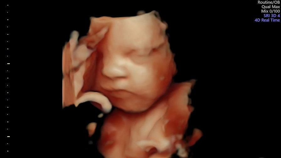 Oh Baby 4D Ultrasound