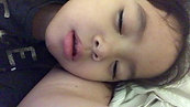 Sleeping before surgery with lips open and noisy